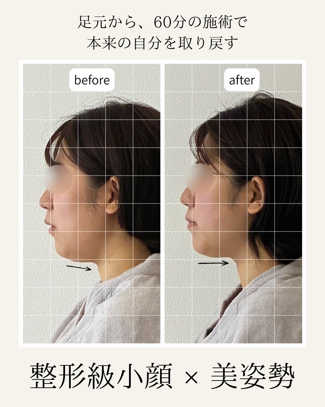 足元から小顔美容矯正