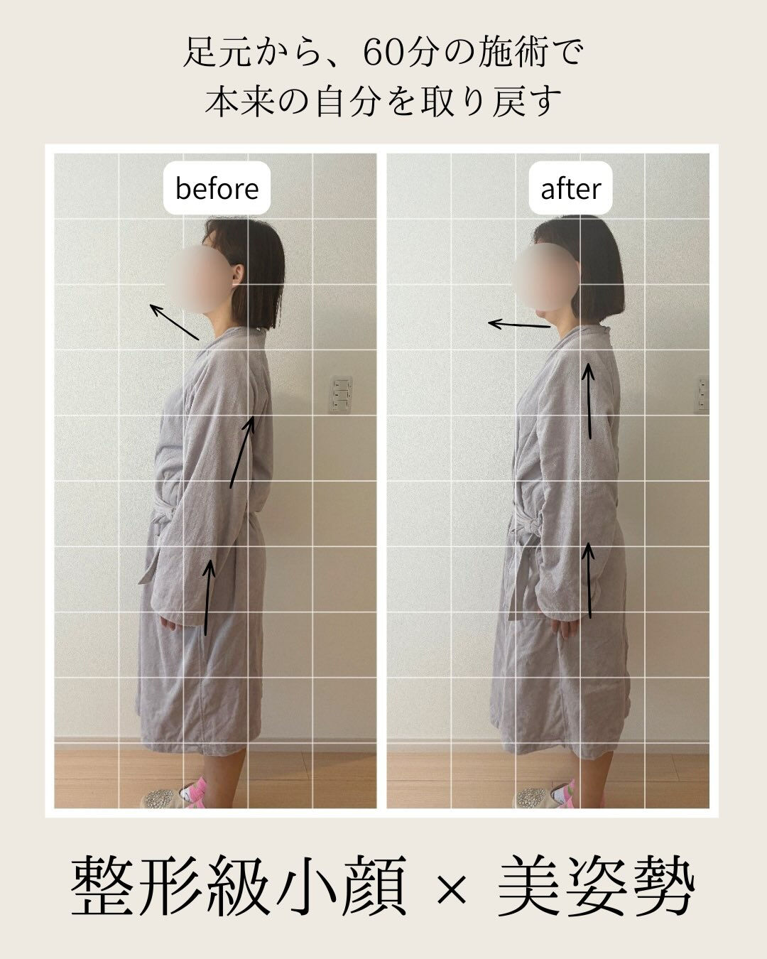 足元から小顔美容矯正